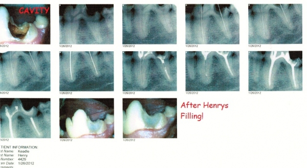 Henry's Cavity