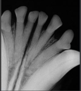 xray