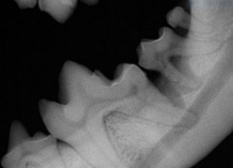Xray